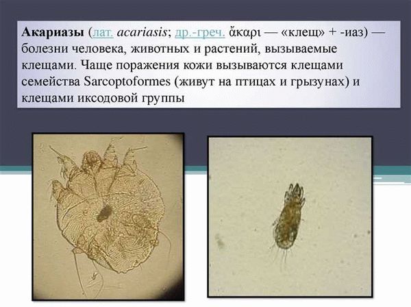 Симптомы и лечение заболеваний наружного уха и отита