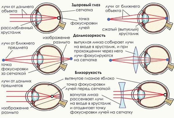 Как проводят измерение зрения