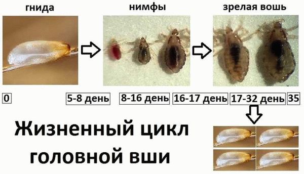 Педикулез: возможность самоизлечения?