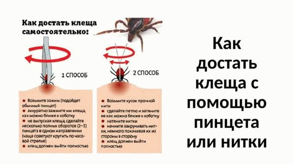 Что нужно для извлечения клеща?