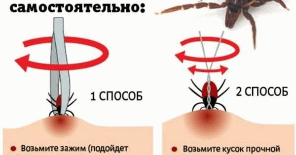 Основные способы удаления клещей