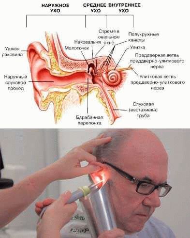 Как удалить инородное тело из уха?