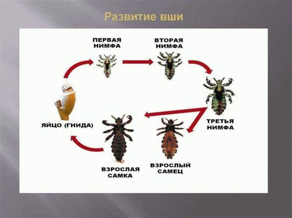 Заражение педикулезом и профилактика