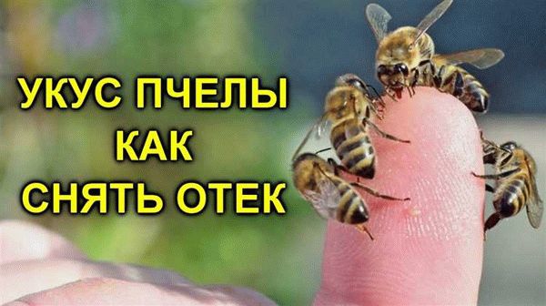 Чем опасны жалящие насекомые?