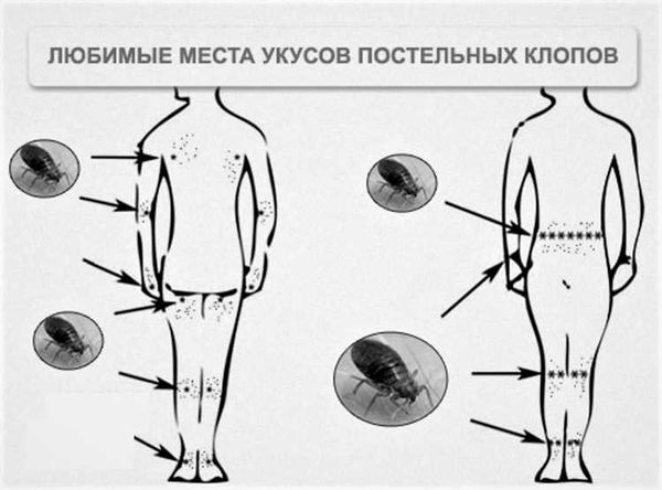 Как снизить зуд и какие препараты для этого пригодны